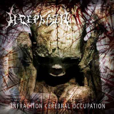 Acephala - Infraction Cerebral Occupation CD